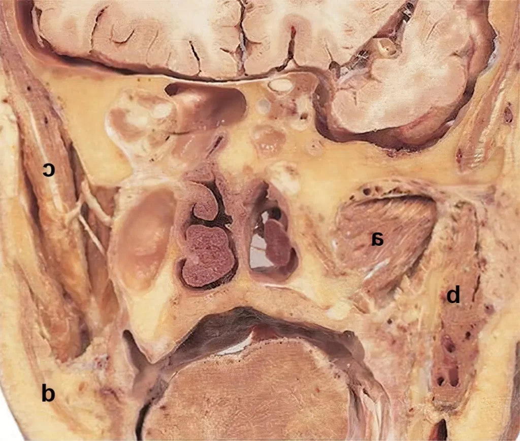 ENT Mock OSCE Test March 2022